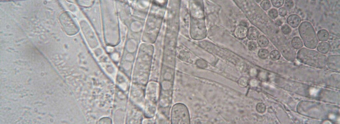 Mikrobiom Entdecken: Die Rolle Deiner Darmflora und Wie Du Sie Unterstützen Kannst